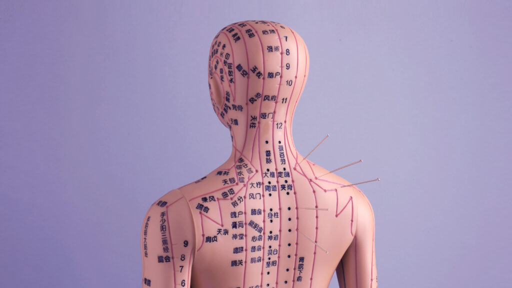 Иллюстрация к статье: Акупунктура: сколько игл можно воткнуть в&nbsp;тело человека?